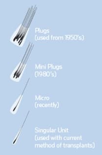 FUE Hair Transplants - Follicular Unit Extraction Australia