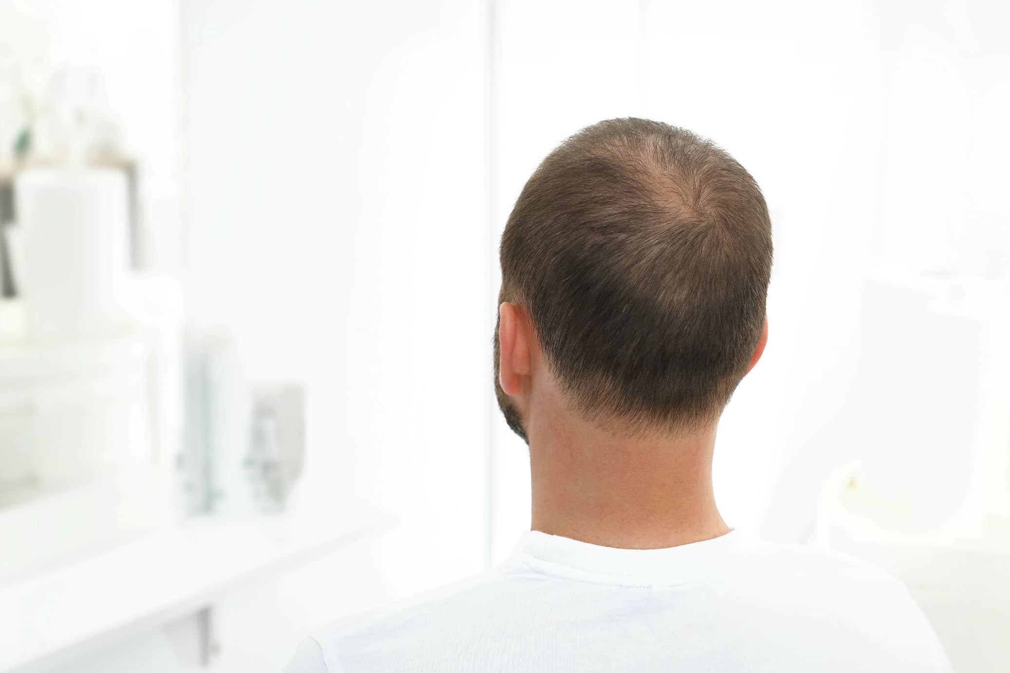 Best Haircut For A Receding Hairline Options For Thinning Baldness